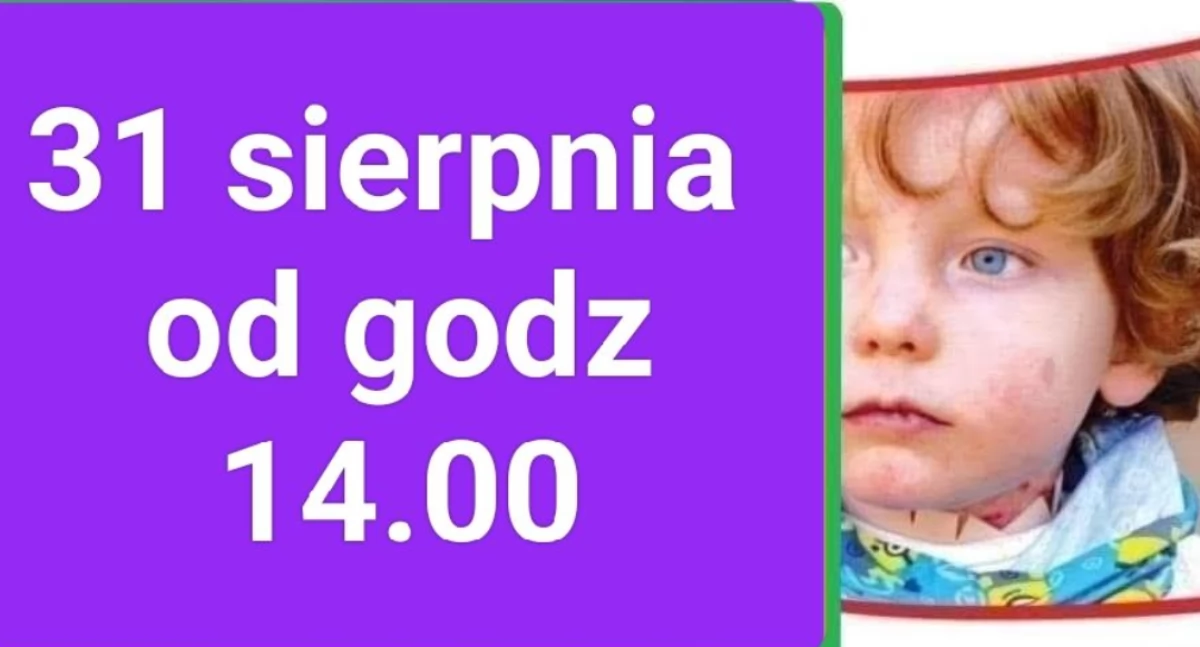 Pomagamy , Zbiórka korków puszek Krzysia przyłącz pomóż! - zdjęcie, fotografia